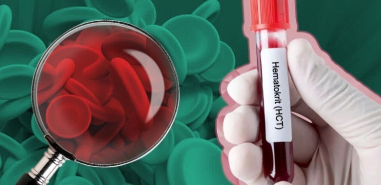 HCT Nedir? Düşüklüğü ve Yüksekliği Ne Anlama Gelir?