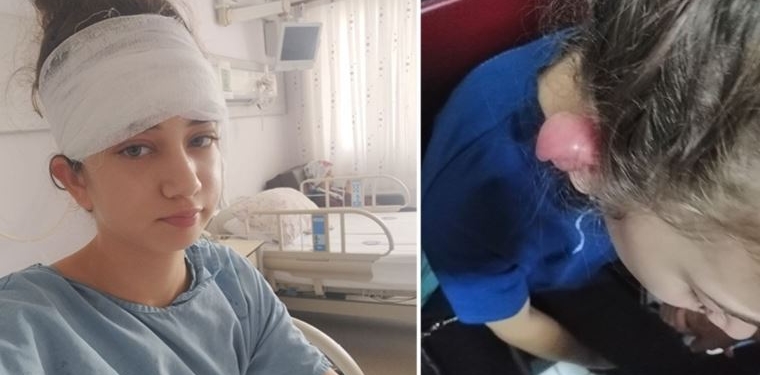 Küpe taktırmak için kulağını deldirdi, hastanelik oldu