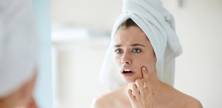 Yüzdeki beyaz lekelerden nasıl kurtulabiliriz?